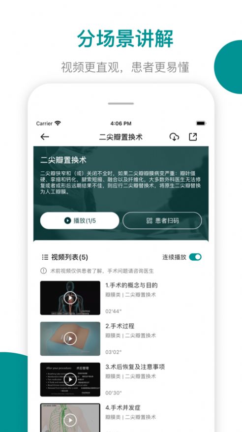 心术通手机版