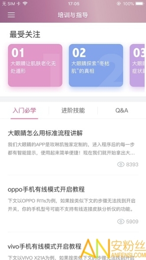 肌肤分析仪图2