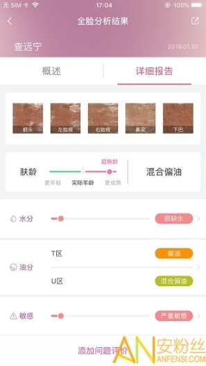 肌肤分析仪图5