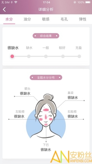 肌肤分析仪图4