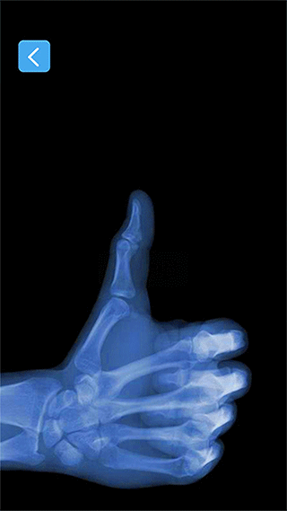 x射线模拟器图4