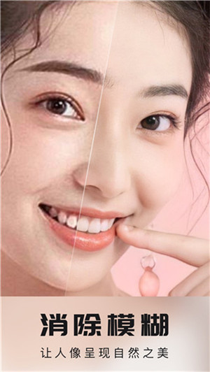 你我當(dāng)年AI畫(huà)質(zhì)修復(fù) v3.1.5 安卓版