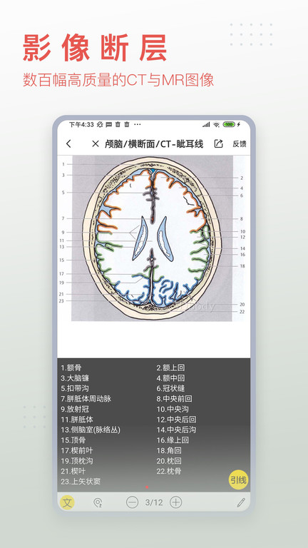 3dbody解剖学(3)