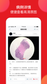 爱病理图3
