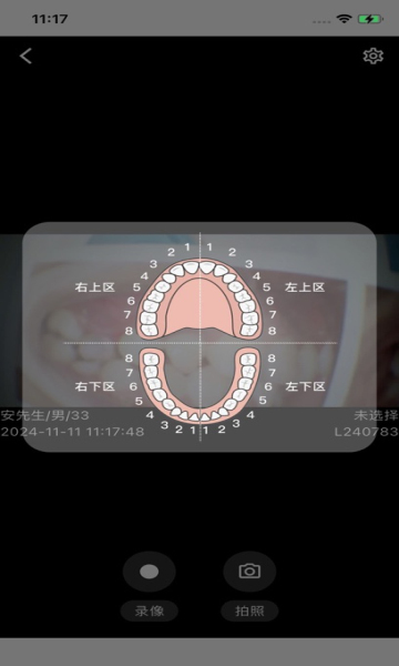 慧视健康口腔观察仪