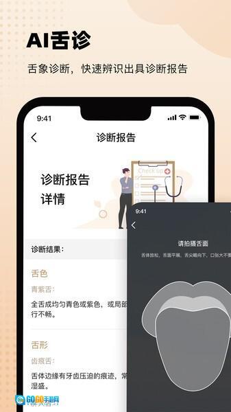 中医舌诊图解大全图4