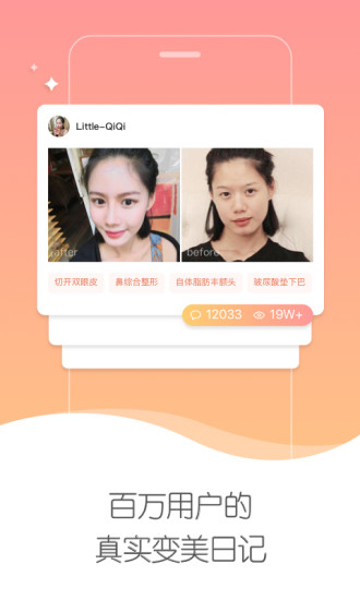 美黛拉(1)