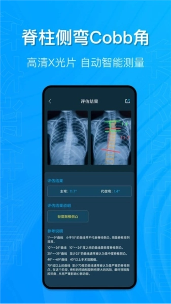 体态评估大师(1)