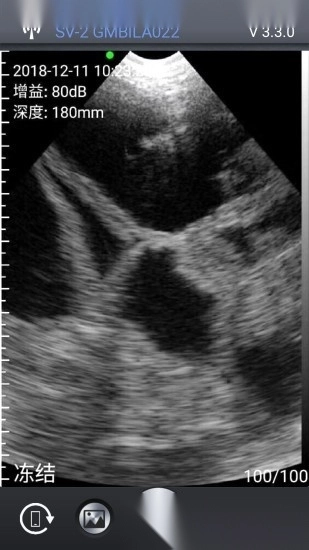 智能B超手机版图1