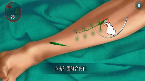 外科医生挑战游戏图3