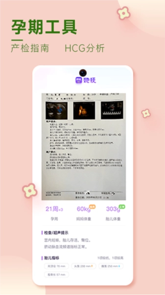她抚孕育图2