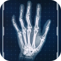 真实x射线模拟器