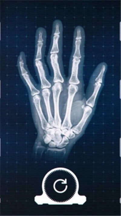 真实x射线模拟器