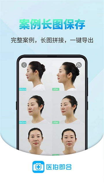 医拍即合无广告版图1