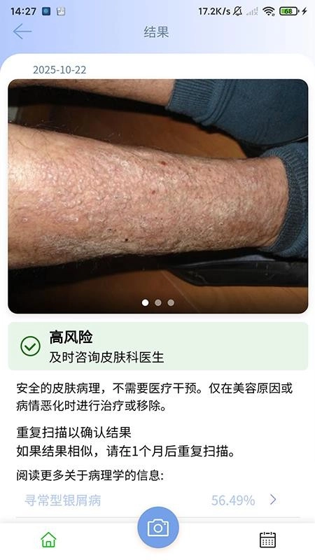 医用皮肤镜影像处理免费原版图4