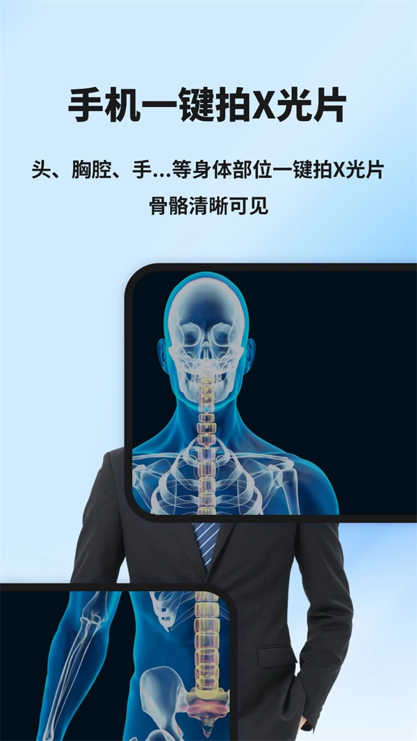 模拟X射线直装游戏版(1)
